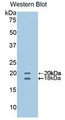 Western Blot; Sample: Recombinant protein.