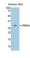 Western Blot; Sample: Recombinant protein.