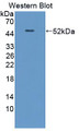 Western Blot; Sample: Recombinant protein.