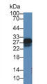 Western Blot; Sample: Rat Serum; Primary Ab: 2µg/mL Rabbit Anti-Rat SOD3 Antibody Second Ab: 0.2µg/mL HRP-Linked Caprine Anti-Rabbit IgG Polyclonal Antibody