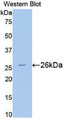 Western Blot; Sample: Recombinant protein.