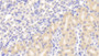 DAB staining on fromalin fixed paraffin-embedded Kidney tissue)