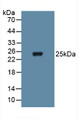 Western Blot; Sample: Human Blood Cells.