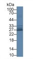 Western Blot; Sample: Human Lung lysate; ; Primary Ab: 1µg/ml Rabbit Anti-Human SOD3 Antibody; Second Ab: 0.2µg/mL HRP-Linked Caprine Anti-Rabbit IgG Polyclonal Antibody;