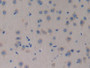 DAB staining on IHC-P; Samples: Mouse Brain Tissue; Primary Ab: 10µg/ml Rabbit Anti-Mouse NT4 Antibody Second Ab: 2µg/mL HRP-Linked Caprine Anti-Rabbit IgG Polyclonal Antibody