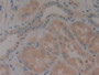 DAB staining on IHC-P; Samples: Human Kidney Tissue; Primary Ab: 10µg/ml Rabbit Anti-Human NT4 Antibody Second Ab: 2µg/mL HRP-Linked Caprine Anti-Rabbit IgG Polyclonal Antibody