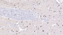 DAB staining on IHC-P; Samples: Human Cerebrum Tissue;  Primary Ab: 20µg/ml Rabbit Anti-Human NT3 Antibody Second Ab: 2µg/mL HRP-Linked Caprine Anti-Rabbit IgG Polyclonal Antibody 