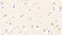 DAB staining on IHC-P; Samples: Human Cerebrum Tissue;  Primary Ab: 20μg/ml Rabbit Anti-Human NT3 Antibody Second Ab: 2µg/mL HRP-Linked Caprine Anti-Rabbit IgG Polyclonal Antibody 