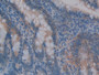 DAB staining on IHC-P; Samples: Rat Intestine Tissue; Primary Ab: 10µg/ml Rabbit Anti-Rat MMP3 Antibody Second Ab: 2µg/mL HRP-Linked Caprine Anti-Rabbit IgG Polyclonal Antibody