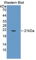 Western Blot; Sample: Recombinant protein.