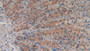DAB staining on fromalin fixed paraffin- embedded pancreas tissue)