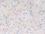 DAB staining on IHC-P; Samples: Human Cerebrum Tissue;  Primary Ab: 30µg/ml Rabbit Anti-Human MMP3 A