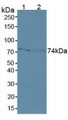 Western Blot; Sample: Lane1: Human MCF7 Cells; Lane2: Human A431 Cells.