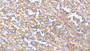 DAB staining on IHC-P; Samples: Human Stomach Tissue; Primary Ab: 10µg/ml Rabbit Anti-Human MMP2 Antibody Second Ab: 2µg/mL HRP-Linked Caprine Anti-Rabbit IgG Polyclonal Antibody