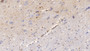 DAB staining on fromalin fixed paraffin-embedded Stomach tissue)