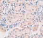 Matrix Metalloproteinase 13 (Mmp13) Polyclonal Antibody, Cat#CAU28614