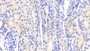 DAB staining on IHC-P; Samples: Porcine Kidney Tissue; Primary Ab: 10μg/ml Rabbit Anti-Porcine MMP13 Antibody Second Ab: 2µg/mL HRP-Linked Caprine Anti-Rabbit IgG Polyclonal Antibody