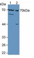 Figure. Western Blot; Sample: Lane1: Mouse Liver Tissue; Lane2: Mouse Breast Cancer Tissue.