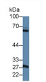 Western Blot; Sample: Rat Pancreas lysate; ;Primary Ab: 1µg/ml Rabbit Anti-Rat MMP1 Antibody;Second Ab: 0.2µg/mL HRP-Linked Caprine Anti-Rabbit IgG Polyclonal Antibody;