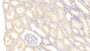 DAB staining on IHC-P; Samples: Human Kidney Tissue;  Primary Ab: 20μg/ml Rabbit Anti-Human MMP1 Antibody Second Ab: 2µg/mL HRP-Linked Caprine Anti-Rabbit IgG Polyclonal Antibody 