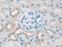 DAB staining on IHC-P; Samples: Mouse Kidney Tissue;  Primary Ab: 20µg/ml Rabbit Anti-Mouse CASP11 A
