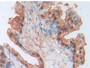 DAB staining on IHC-P; Samples: Human Prostate Gland Tissue