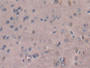 DAB staining on IHC-P; Samples: Mouse Cerebrum Tissue; Primary Ab: 30µg/ml Rabbit Anti-Mouse MCSF Antibody Second Ab: 2µg/mL HRP-Linked Caprine Anti-Rabbit IgG Polyclonal Antibody