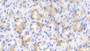 DAB staining on IHC-P; Samples: Porcine Stomach Tissue;  Primary Ab: 20μg/ml Rabbit Anti-Porcine MCP2 Antibody Second Ab: 2µg/mL HRP-Linked Caprine Anti-Rabbit IgG Polyclonal Antibody 