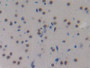 DAB staining on IHC-P; Samples: Mouse Brain Tissue; Primary Ab: 10µg/ml Rabbit Anti-Mouse MCP2 Antibody Second Ab: 2µg/mL HRP-Linked Caprine Anti-Rabbit IgG Polyclonal Antibody