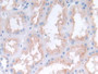 DAB staining on fromalin fixed paraffin-embedded Kidney tissue)