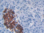 DAB staining on IHC-P;&lt;br/&gt;Samples: Human Pancreas Tissue; &lt;br/&gt;Primary Ab: 30µg/ml Rabbit Anti-Human MCP1 Antibody&lt;br/&gt;Second Ab: 2µg/mL HRP-Linked Caprine Anti-Rabbit IgG Polyclonal Antibody&lt;br/&gt;