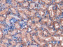DAB staining on IHC-P; Samples: Rat Kidney Tissue; Primary Ab: 10µg/ml Rabbit Anti-Rat MCP1 Antibody Second Ab: 2µg/mL HRP-Linked Caprine Anti-Rabbit IgG Polyclonal Antibody