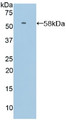 Western Blot; Sample: Recombinant SELL, Human.