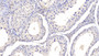 DAB staining on IHC-P; Samples: Bovine Testis Tissue; Primary Ab: 20μg/ml Rabbit Anti-Bovine LEP Antibody Second Ab: 2µg/mL HRP-Linked Caprine Anti-Rabbit IgG Polyclonal Antibody