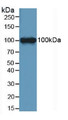 Western Blot; Sample: Mouse Brain Tissue.