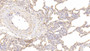 DAB staining on IHC-P; Samples: Human Lung Tissue; Primary Ab: 20μg/ml Rabbit Anti-Human IL9 Antibody Second Ab: 2µg/mL HRP-Linked Caprine Anti-Rabbit IgG Polyclonal Antibody