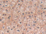 DAB staining on IHC-P; Samples: Human Liver Tissue; Primary Ab: 30µg/ml Rabbit Anti-Human IL4 Antibody Second Ab: 2µg/mL HRP-Linked Caprine Anti-Rabbit IgG Polyclonal Antibody