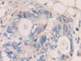 DAB staining on fromalin fixed paraffin- embedded Kidney tissue)