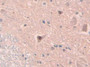 DAB staining on IHC-P; Samples: Rat Spinal cord Tissue; Primary Ab: 20µg/ml Rabbit Anti-Rat IL18 Antibody Second Ab: 2µg/mL HRP-Linked Caprine Anti-Rabbit IgG Polyclonal Antibody