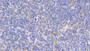DAB staining on IHC-P; Samples: Porcine Lymph node Tissue; Primary Ab: 20μg/ml Rabbit Anti-Porcine IL18 Antibody Second Ab: 2µg/mL HRP-Linked Caprine Anti-Rabbit IgG Polyclonal Antibody