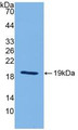 Western Blot; Sample: Recombinant IL18, Mouse.