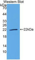 Western Blot; Sample: Recombinant protein.