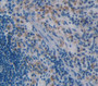 Interleukin 15 (Il15) Polyclonal Antibody, Cat#CAU28783