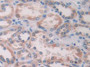 DAB staining on IHC-P; Samples: Human Kidney Tissue; Primary Ab: 20µg/ml Rabbit Anti-Human IL15 Antibody Second Ab: 2µg/mL HRP-Linked Caprine Anti-Rabbit IgG Polyclonal Antibody