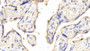 DAB staining on IHC-P; Samples: Human Placenta Tissue; Primary Ab: 20μg/ml Rabbit Anti-Porcine IL12A Antibody Second Ab: 2µg/mL HRP-Linked Caprine Anti-Rabbit IgG Polyclonal Antibody