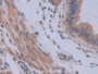 DAB staining on IHC-P; Samples: Mouse Uterus Tissue; Primary Ab: 10µg/ml Rabbit Anti-Mouse IL12A Antibody Second Ab: 2µg/mL HRP-Linked Caprine Anti-Rabbit IgG Polyclonal Antibody