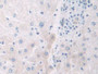 DAB staining on IHC-P; Samples: Human Liver Tissue; Primary Ab: 30µg/ml Rabbit Anti-Human IL12A Antibody Second Ab: 2µg/mL HRP-Linked Caprine Anti-Rabbit IgG Polyclonal Antibody