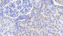 DAB staining on IHC-P; Samples: Porcine Kidney Tissue;  Primary Ab: 20μg/ml Rabbit Anti-Porcine IL12B Antibody Second Ab: 2µg/mL HRP-Linked Caprine Anti-Rabbit IgG Polyclonal Antibody 