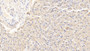 DAB staining on IHC-P; Samples: Canine Liver Tissue; Primary Ab: 20μg/ml Rabbit Anti-Canine IL12B Antibody Second Ab: 2µg/mL HRP-Linked Caprine Anti-Rabbit IgG Polyclonal Antibody