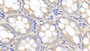 DAB staining on IHC-P; Samples: Canine Colon Tissue; Primary Ab: 20μg/ml Rabbit Anti-Canine IL12B Antibody Second Ab: 2µg/mL HRP-Linked Caprine Anti-Rabbit IgG Polyclonal Antibody